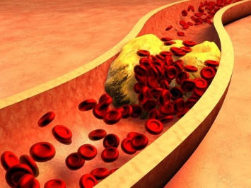 Употребление фруктов, овощей, сахара, специй и чеснока снижает уровень "плохого" холестерина