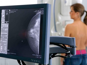 Московских женщин приглашают на бесплатную маммографию и УЗИ
