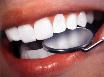 5 главных мифов об отбеливании зубов