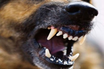 В Харькове собака укусила девушку на глазах у равнодушного хозяина (фото)