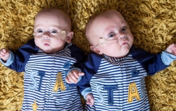 Британка родила наименьших в мире близнецов