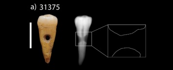 В Турции найдены украшения из человеческих зубов