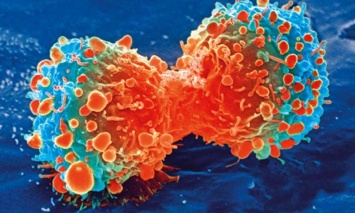 Ученые раскрыли механизм формирования раковых заболеваний