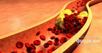 Назван простой способ снизить уровень холестерина в крови