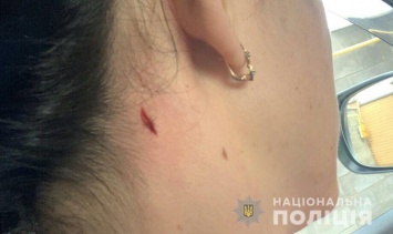 В Николаеве полиция открыла уголовное производство по факту пулевого ранения женщины неподалеку от полицейского стрельбища (ФОТО)