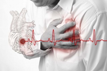 Минздрав обнародовал перечень безоплатных медуслуг при инфаркте/инсульте
