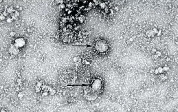 Появилось фото "китайского" коронавируса