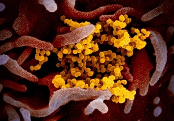 Ученые показали, как выглядит коронавирус COVID-19 под микроскопом (снимки)