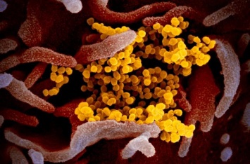 При повторном обследовании у американки обнаружили коронавирус, хотя первое тестирование ничего не показало - Newsweek