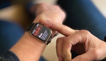 Что не так с Apple Watch