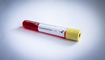 Правозащитники рассказали о ситуации с коронавирусом в ОРДЛО