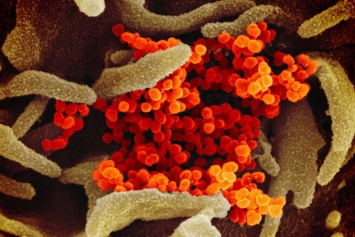 Ученые рассказали об устойчивости коронавируса на твердых поверхностях