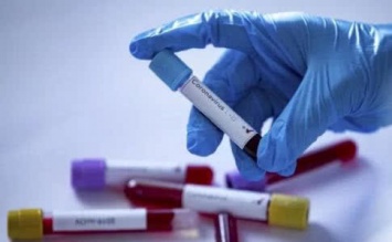 В Запорожской области проверяют на коронавирус 4 образца: за сутки добавился один подозрительный случай