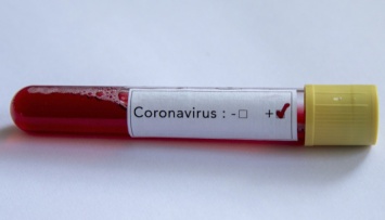 На Харьковщине лабораторно подтвердили первый случай коронавируса