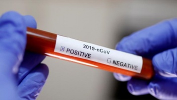 Когда должны делать тест на коронавирус, и что делать если отказывают: ответ Минздрава Украины