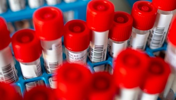 В Мелитополе главврач горбольницы заразился коронавирусом, 12 медиков на самоизоляции