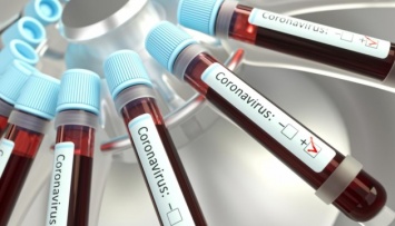На Одесчине у 14 человек подтвердили коронавирус, еще 124 подозрения проверяют