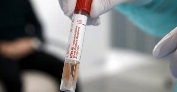 В ВСУ зафиксирована первая жертва коронавируса