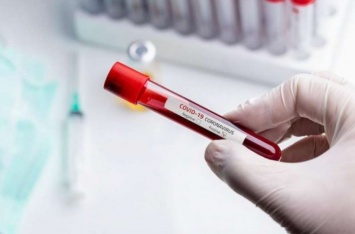 Во Львове паника - врачей масово тестируют на коронавирус