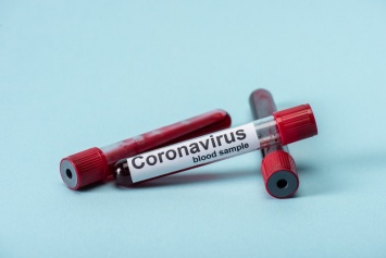 Где в Запорожье сделать тест на коронавирус и сколько это стоит