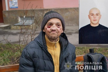 Амфетамин ''съел'' молодого украинца за 2 года: зубы выпали, челюсть сгнила. Фото 18+