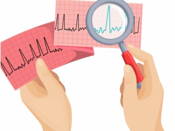 Контроль артериального давления снижает риск фибрилляции предсердий, инфаркта и инсульта - исследование