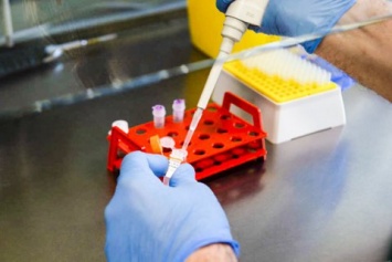 В Житомирской области из-за перегруженности лаборатории ограничат тестирование на коронавирус (обновлено)