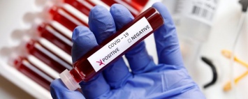 Медики Днепра спасли девушку с диагнозом коронавирус