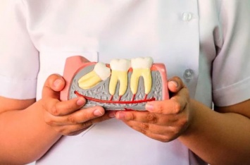 Атипичное удаление зубов: когда показано и как проводится