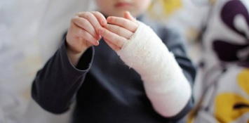 В Запорожской области врач травмпункта лечил двойной перелом у ребенка мазью (ФОТО)