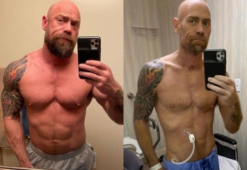 ''Не мог даже держать телефон'': медбрат из США за время болезни COVID-19 потерял 23 кг. Фото до и после