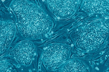 Ученые впервые пересадили стволовые клетки новорожденному