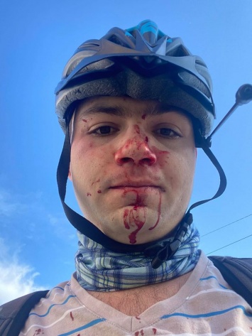 В Киеве выехавший на тротуар водитель атаковал велосипедиста, сделавшего ему замечание. Фото