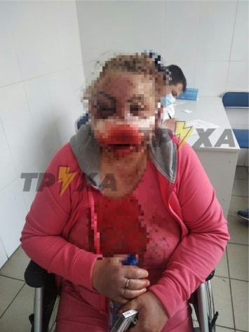 В Харькове трое неизвестных в медицинских масках избили и связали телефонным проводом пенсионерку