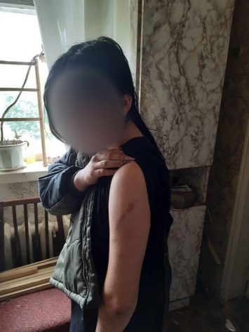 На Луганщине мать решила "воспитать" дочь и посадила ее на цепь (фото)