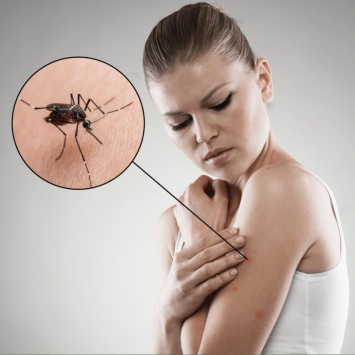Укусил комар: как снять зуд от укуса