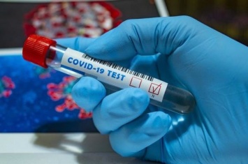 Ученые считают, что эпидемия коронавируса в Украине пошла на спад
