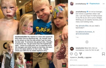 Звезда "Капитана Америки" записал видео для 6-летнего героя, который спас сестру от собаки и пострадал