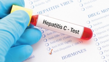 Диагностику вирусных гепатитов планируют внести в Программу медгарантий