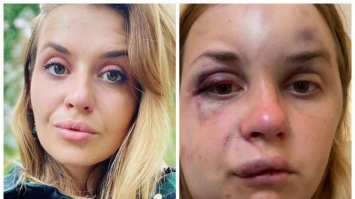 Нападение на женщину в купе: "Укрзализныця" уволит ряд сотрудников