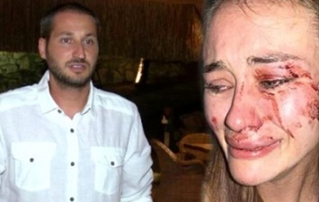 Нападение на украинскую модель в Турции: хозяин пляжа заявил о клевете