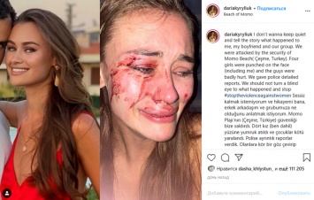 Украинскую модель избили на пляже в Турции. Она назвала обидчиков, но что-то здесь не клеится
