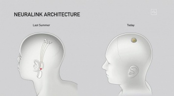 Neuralink V2 - новая версия интерфейса "человеческий мозг-компьютер" от Илона Маска