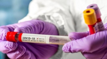 Коронавирус в Украине: Минздрав изменил механизм оказания помощи пациентам с подозрением на COVID-19