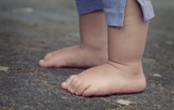 Ноги отказали из-за простуды: в Одессе врач чуть не погубила маленького ребенка