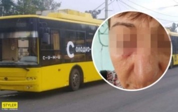В Сумах пассажир изувечила кондуктора из-за маски: фото и детали ЧП