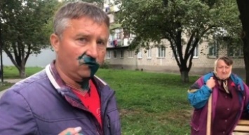 В Житомире депутата от «Оппоблока» облили зеленкой