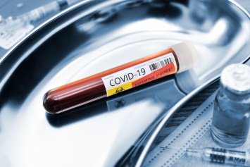 Ученые обнаружили связь между лихорадкой денге и иммунитетом к COVID-19