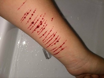 Многочисленные порезы левой руки: за насилие над ребенком дружковчанку привлекли к ответственности
