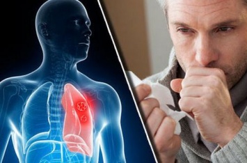 Как вылечить кашель любой степени запущенности: 8 шагов